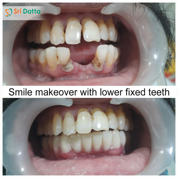 Cover photo of Sri Datta Dental Clinic